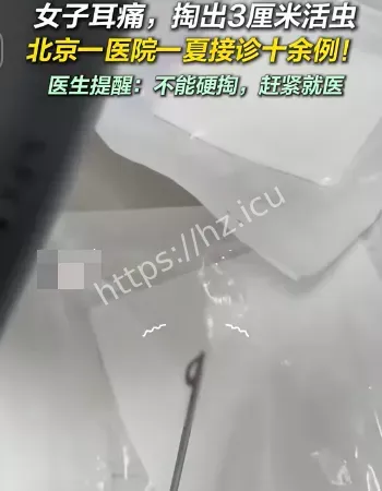 耳痛掏出3厘米活虫
